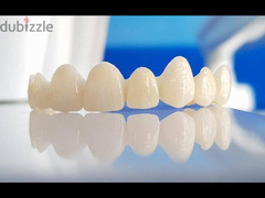تركيبات اسنان - 2