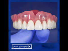 تركيبات اسنان - 1